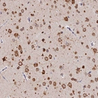 Immunohistochemical staining of human cerebral cortex shows strong cytoplasmic positivity in neurons.