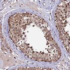 Immunohistochemical staining of human testis shows strong cytoplasmic positivity in cells in seminiferous ducts.