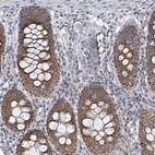 Anti-COQ10B Antibody