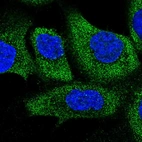 Immunofluorescent staining of human cell line A-431 shows localization to cytosol.