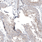 Anti-PPM1J Antibody