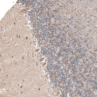 Immunohistochemical staining of human cerebellum shows moderate granular cytoplasmic positivity in Purkinje cells.