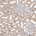 Immunohistochemical staining of human kidney shows moderate granular cytoplasmic positivity in cells in tubules.