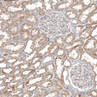 Anti-PPM1J Antibody