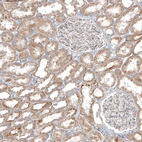 Immunohistochemical staining of human kidney shows moderate granular cytoplasmic positivity in cells in tubules.