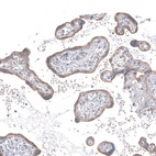 Anti-PPM1J Antibody