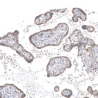 Immunohistochemical staining of human placenta shows moderate granular cytoplasmic positivity in trophoblastic cells.