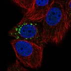 Immunofluorescent staining of human cell line MCF7 shows localization to vesicles.
