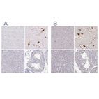 Anti-PMCH Antibody