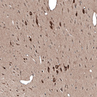 Immunohistochemical staining of rat hypothalamus shows strong cytoplasmic positivity in neurons.