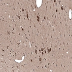 Immunohistochemical staining of rat hypothalamus shows strong cytoplasmic positivity in neurons.