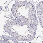 Anti-PMCH Antibody