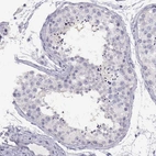 Immunohistochemical staining of human testis shows no positivity in cells in seminiferous ducts as expected.