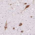 Anti-PMCH Antibody