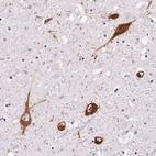 Immunohistochemical staining of human hypothalamus using Anti-PMCH antibody HPA046055.