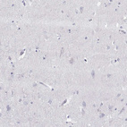 Anti-PMCH Antibody