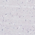 Immunohistochemical staining of human cerebral cortex shows no positivity in neurons.
