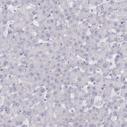 Anti-PMCH Antibody