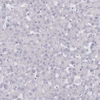 Immunohistochemical staining of human liver shows no positivity in hepatocytes as expected.