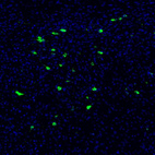 Immunofluorescence staining of mouse brain shows strong positivity in of neurons in the hypothalamus.