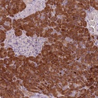 Anti-TLCD2 Antibody