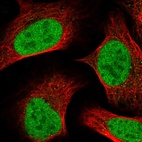 Immunofluorescent staining of human cell line U-2 OS shows localization to nucleoplasm.