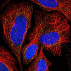 Immunofluorescent staining of human cell line SiHa shows localization to vesicles.