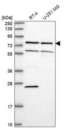 Western blot analysis in human cell line RT-4 and human cell line U-251 MG.