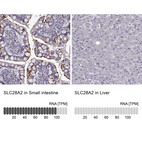 Anti-SLC28A2 Antibody