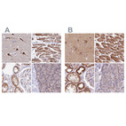 Immunohistochemical staining of human cerebral cortex, heart muscle, kidney and pancreas using Anti-ATP5F1 antibody HPA046067 (A) shows similar protein distribution across tissues to independent antibody HPA057347 (B).
