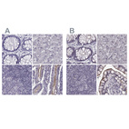 Immunohistochemical staining of human colon, liver, lymph node and small intestine using Anti-SLC28A2 antibody HPA046068 (A) shows similar protein distribution across tissues to independent antibody HPA055623 (B).