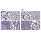 Immunohistochemical staining of human colon, liver, lymph node and small intestine using Anti-SLC28A2 antibody HPA046068 (A) shows similar protein distribution across tissues to independent antibody HPA055623 (B).