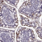 Immunohistochemical staining of human small intestine shows high expression.