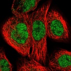 Anti-ERCC3 Antibody