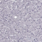 Immunohistochemical staining of human liver shows low expression as expected.