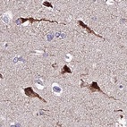 Immunohistochemical staining of human cerebral cortex using Anti-ATP5F1 antibody HPA046067.
