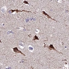 Immunohistochemical staining of human cerebral cortex using Anti-ATP5F1 antibody HPA046067.