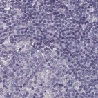 Immunohistochemical staining of human lymph node using Anti-SLC28A2 antibody HPA046068.