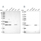 Western blot analysis using Anti-ATP5F1 antibody HPA046067 (A) shows similar pattern to independent antibody HPA057347 (B).