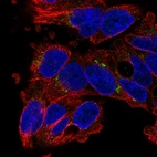 Anti-SLC29A3 Antibody