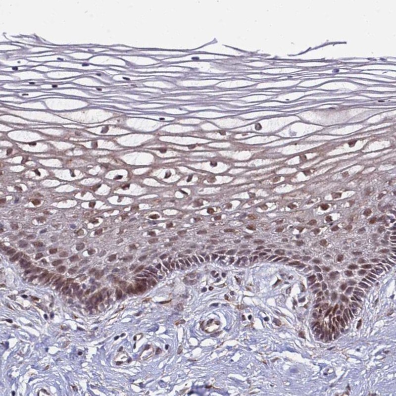 Anti-POLR2D Antibody