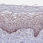 Anti-POLR2D Antibody