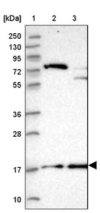 Lane 1: Marker [kDa] 250, 130, 95, 72, 55, 36, 28, 17, 10_br/_Lane 2: Human cell line RT-4_br/_Lane 3: Human cell line U-251MG sp