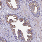 Anti-SPCS1 Antibody