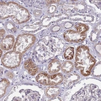 Immunohistochemical staining of human kidney shows moderate cytoplasmic positivity in cells in tubules.