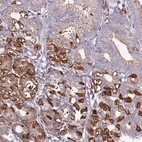 Immunohistochemical staining of human stomach shows strong cytoplasmic positivity in a subset of glandular cells.