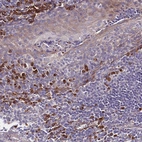 Immunohistochemical staining of human lymphoid tissues shows strong cytoplasmic positivity in a subset of non-germinal center cells.