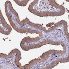 Anti-NPHP1 Antibody