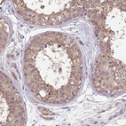 Immunohistochemical staining of human testis shows moderate cytoplasmic positivity in cells in seminiferous ducts.