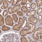 Immunohistochemical staining of human kidney shows strong cytoplasmic positivity in cells in tubules.